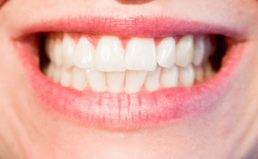 Obecna technologia używana w salonach stomatologii estetycznej zdoła spowodować, że odbierzemy śliczny uśmiech.