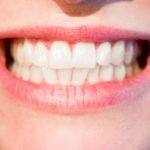 Obecna technologia używana w salonach stomatologii estetycznej zdoła spowodować, że odbierzemy śliczny uśmiech.